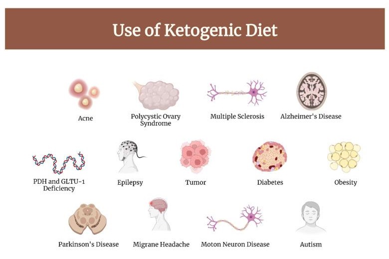Keto Diet for Neurological Disorders